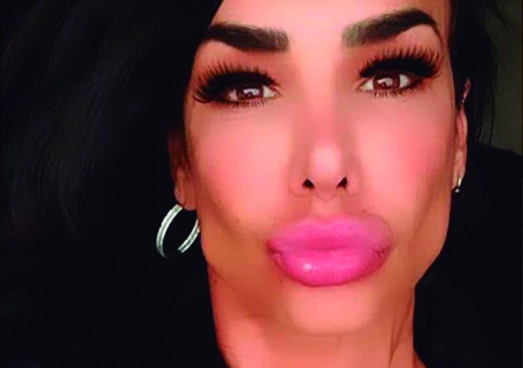 Lis Vega publica fotografía presumiendo sus labios