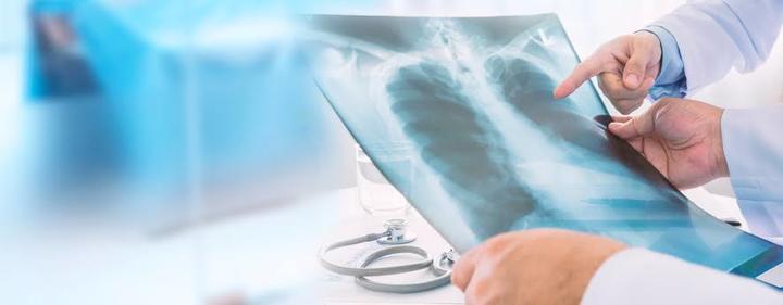 ¿Qué origina el cáncer de pulmón?