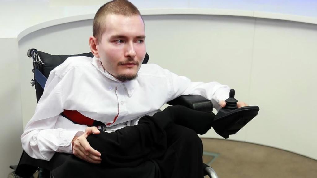 ¿Qué pasó con el hombre que se sometería a un trasplante de cabeza?