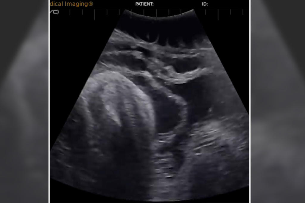 Sorprende el video de un bebé tiburón en el vientre de su madre