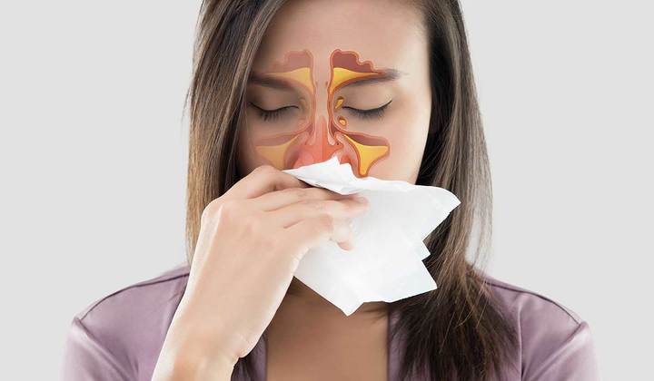 Lavado nasal: técnica sencilla