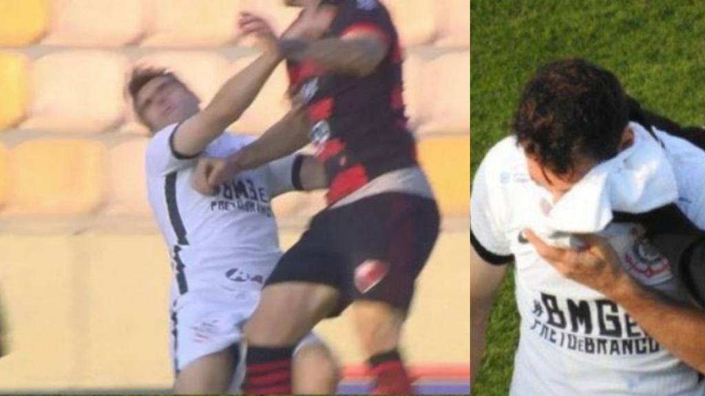 Mauro Boselli sufre fractura en el rostro durante partido