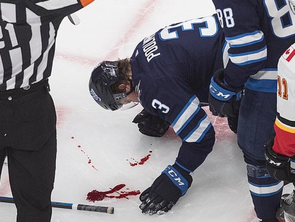 Jugador de hockey recibe un golpe en la cara y deja un rastro de sangre sobre el hielo