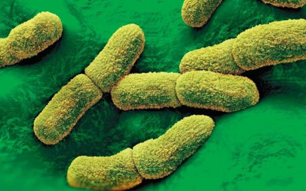 Detectan primer caso de peste bubónica en cinco años en California