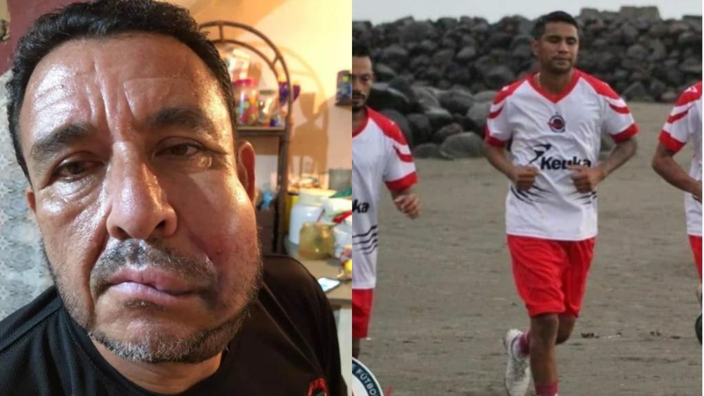 Jugador de la Liga de Balompié Mexicano agrede y desfigura rostro de árbitro