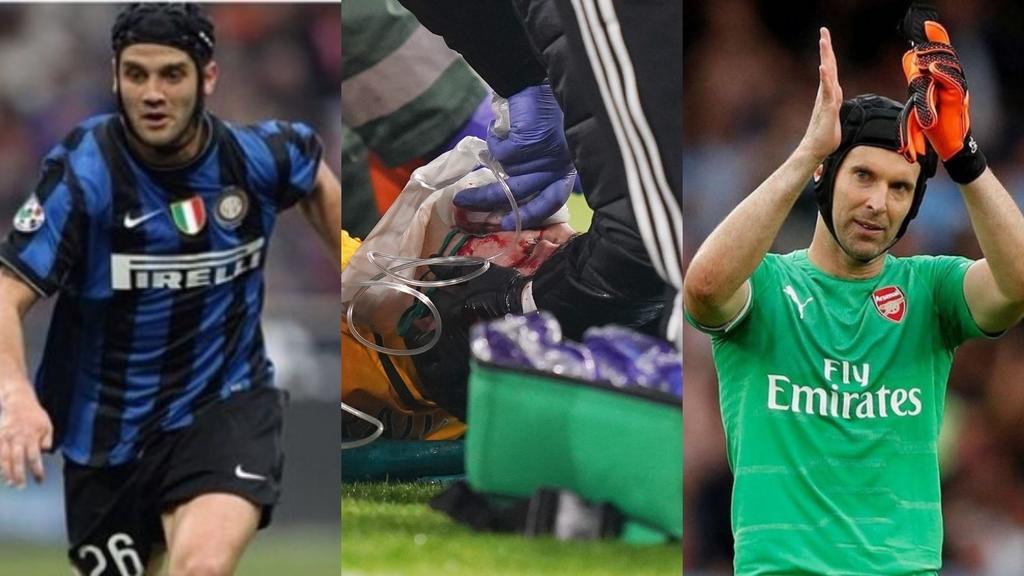 ¿Qué otros jugadores han sufrido fractura de cráneo?