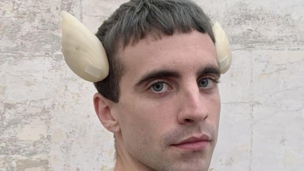 Hombre 'transespecie' se implanta aletas 'de pescado' en el cráneo con microchip