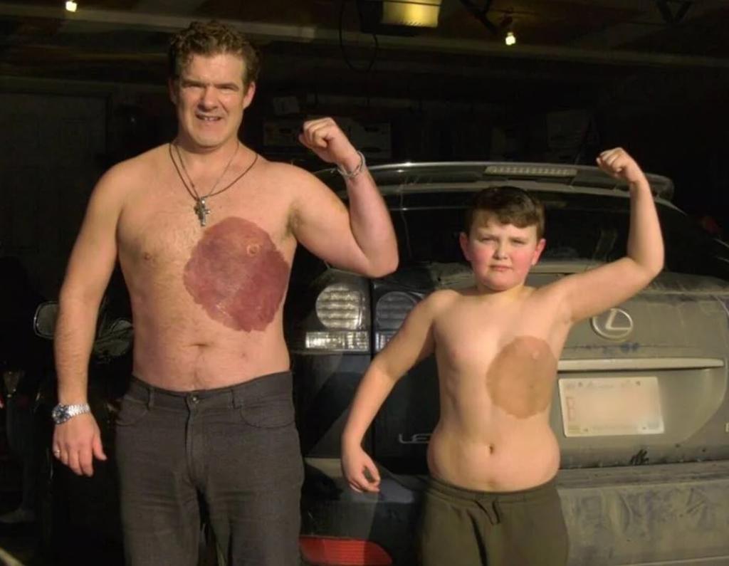 Padre se hace un tatuaje similar a la marca de nacimiento de su hijo