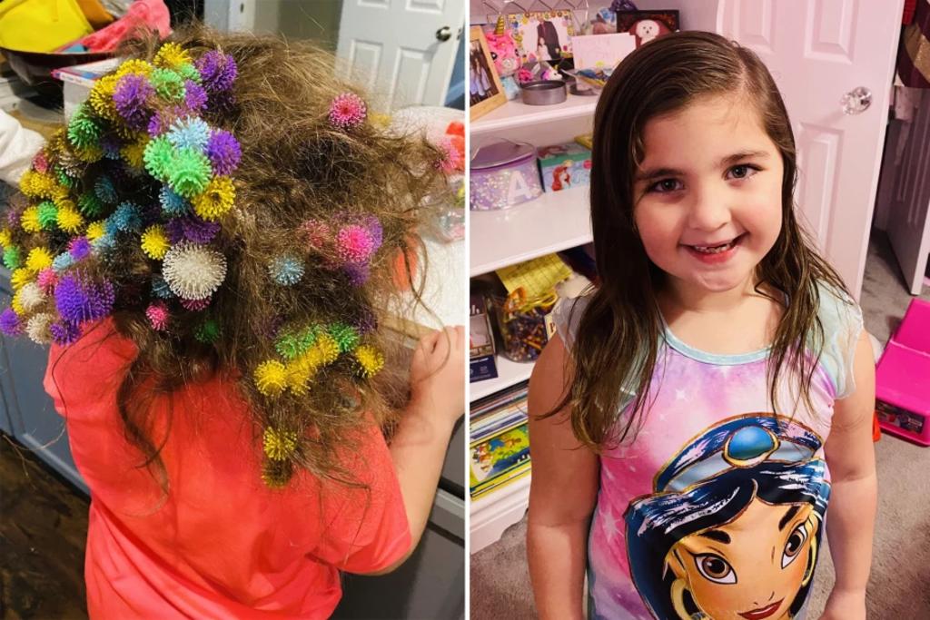Accidente con juguetes deja a madre con la tarea de desenredar el cabello de su hija