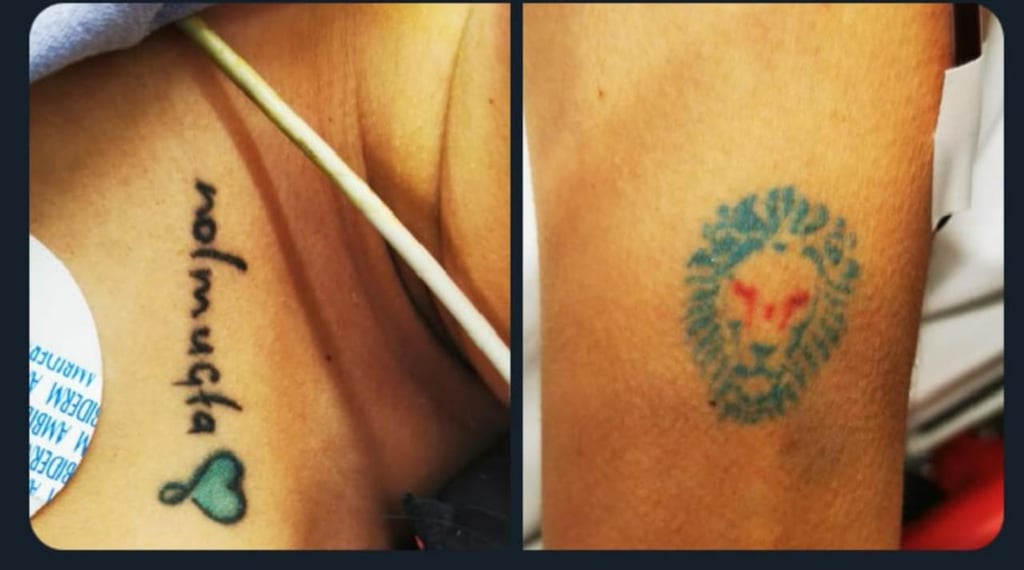 Difunden tatuajes de lesionada en accidente de la Durango-Parral para identificarla