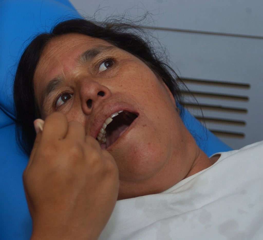 Reportan dos mil atendidos por gingivitis en la entidad