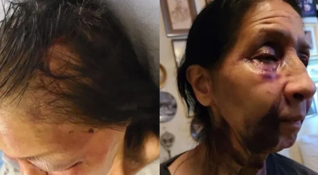 Mujer mexicana es golpeada en EUA por afroamericana; pensó que era asiática