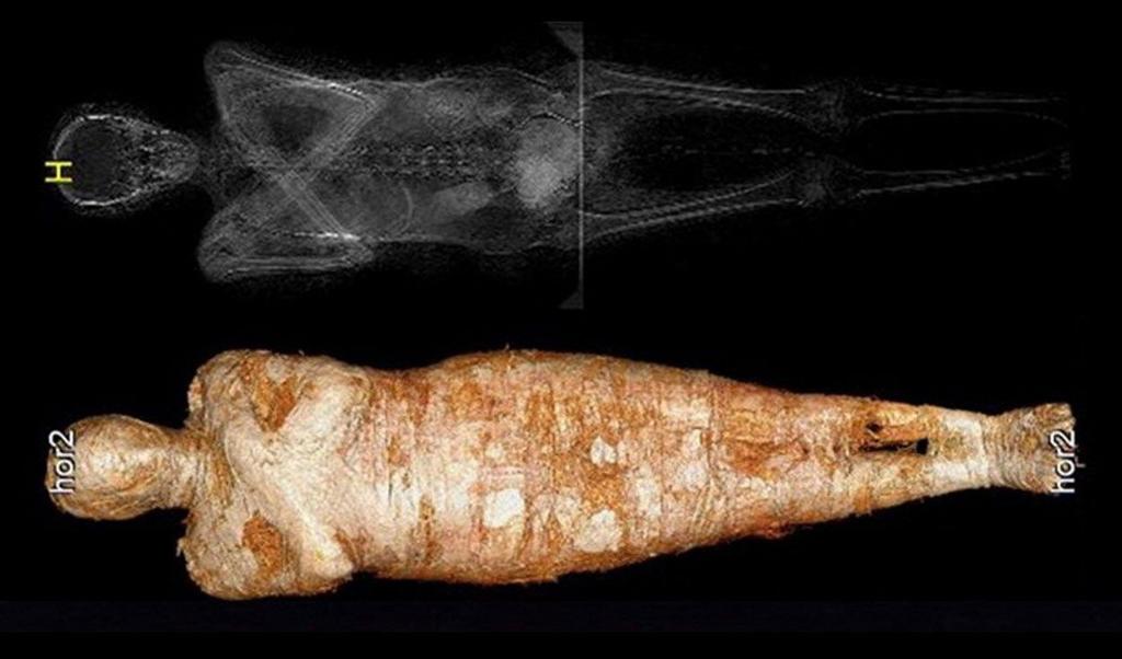 Hallan primer caso de momia egipcia de una embarazada