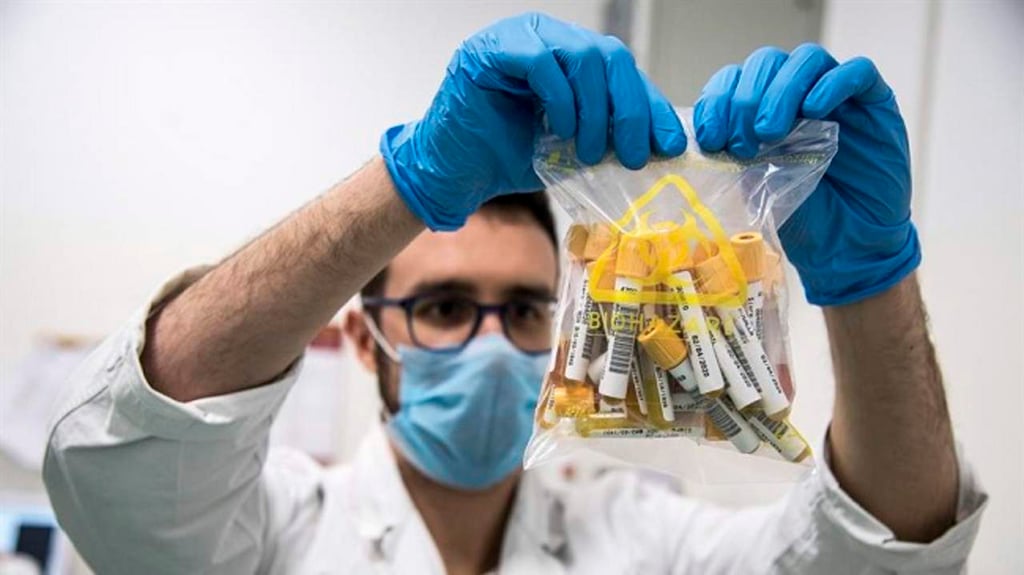 Laboratorio suizo creará depósito mundial de coronavirus para su estudio