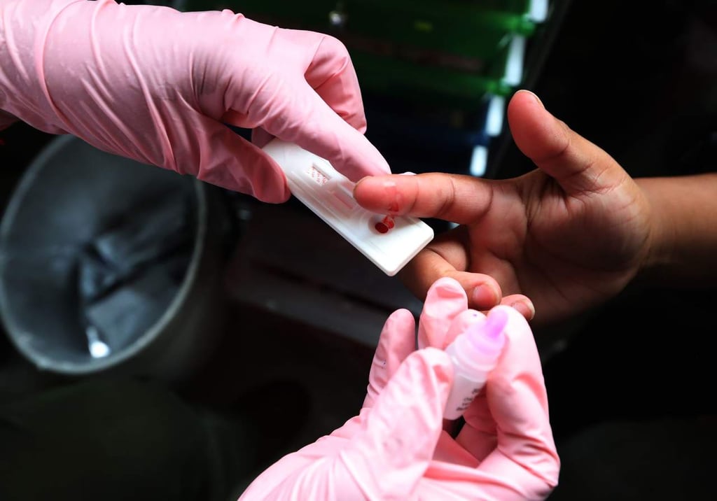 Hasta seis meses sin tratamiento de carga viral para pacientes VIH