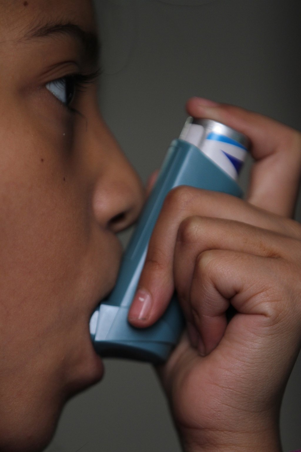 En Durango, van 629 atendidos por asma en el año