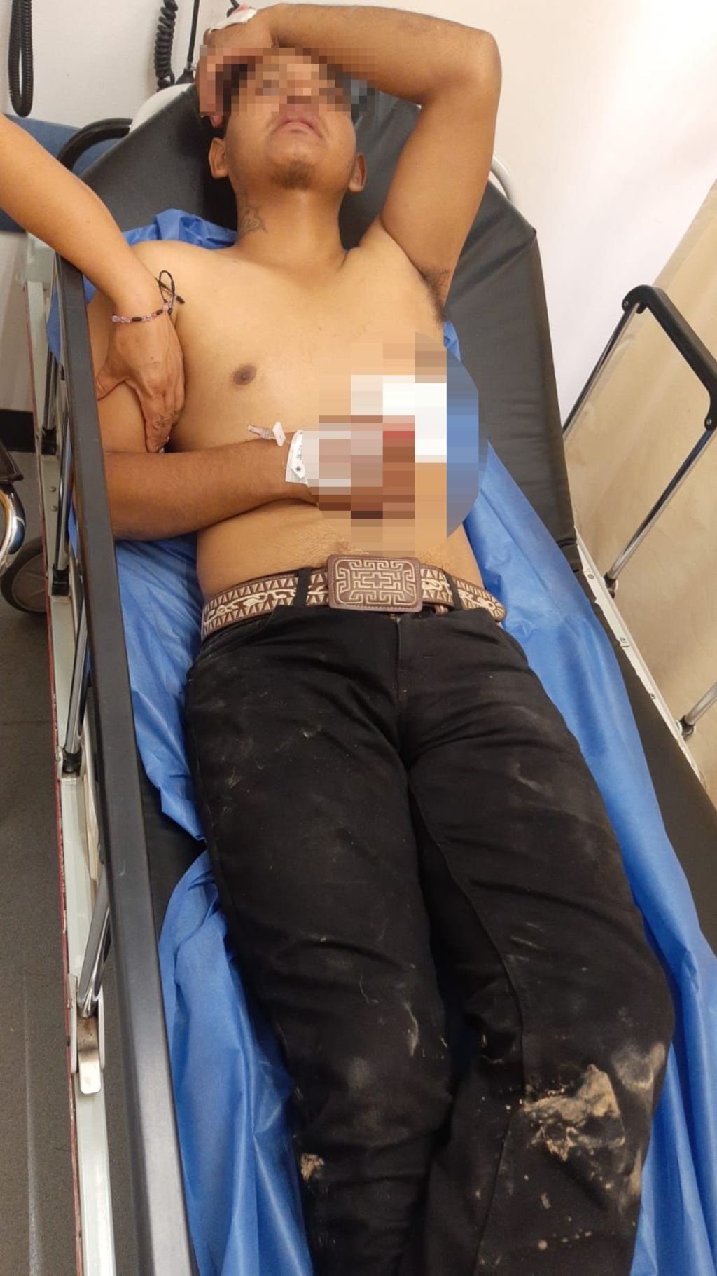 Sujeto es apuñalado por su joven cuñado; lo hospitalizan en Gómez Palacio