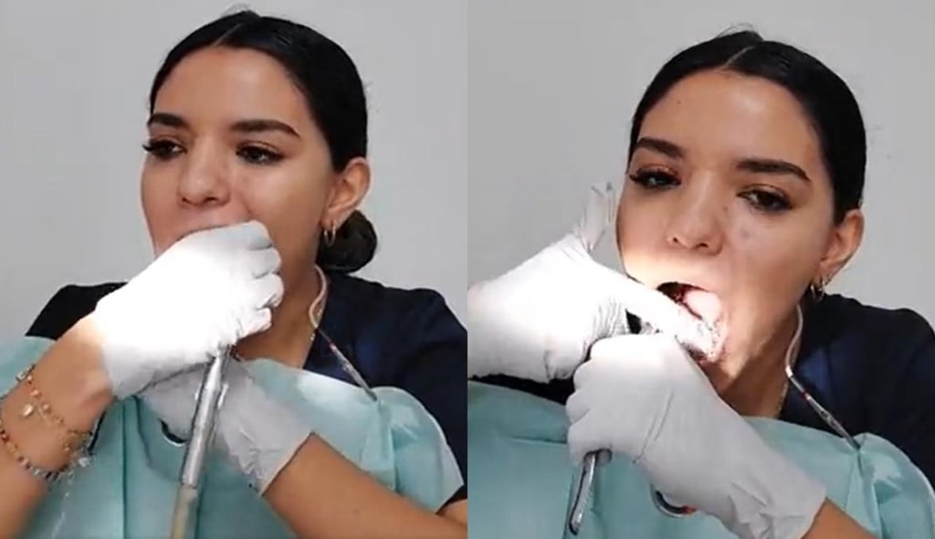 VIRAL: Mujer se quita las muelas del juicio sola y lo comparte en redes