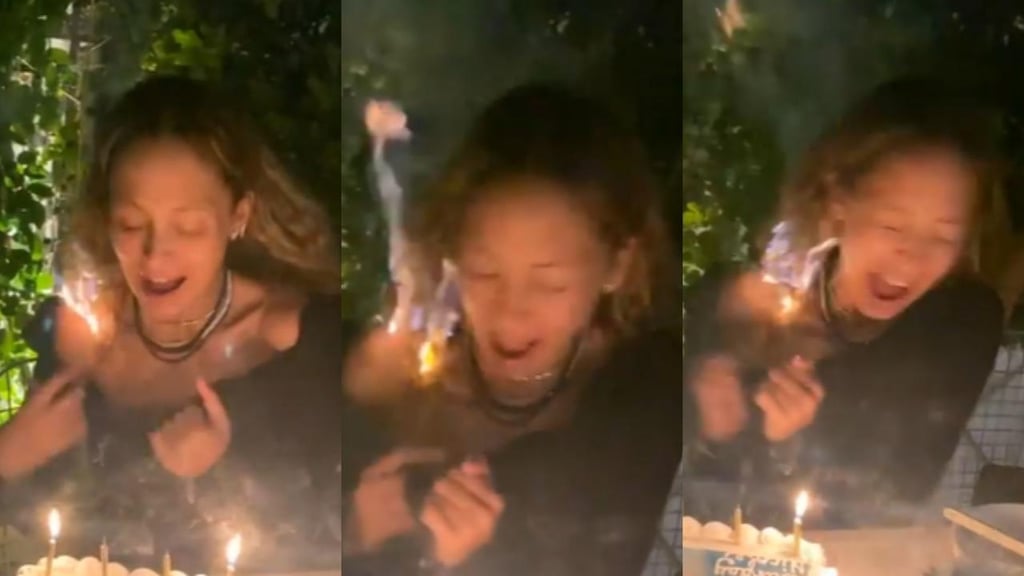 Nicole Richie se incendia el rostro al apagar las velas de un pastel