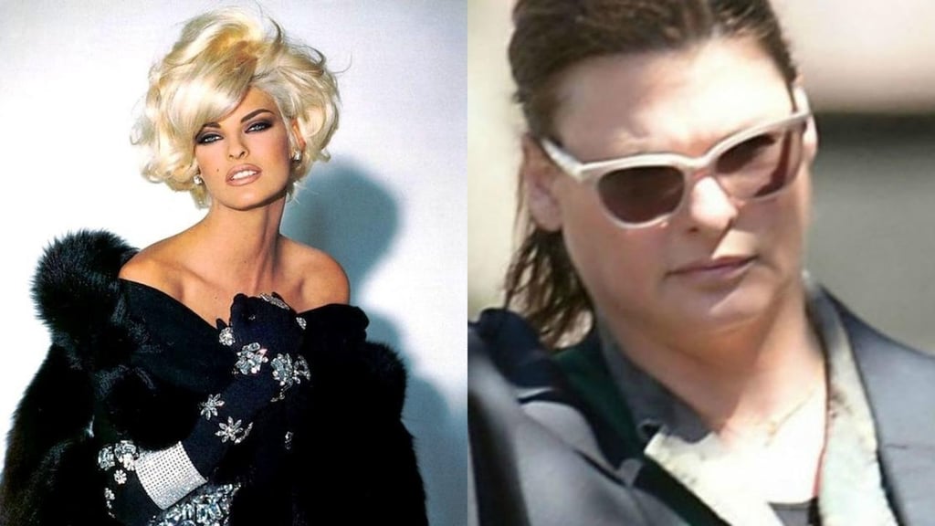 Linda Evangelista sufre fuerte depresión tras quedar ‘desfigurada’ por tratamiento estético