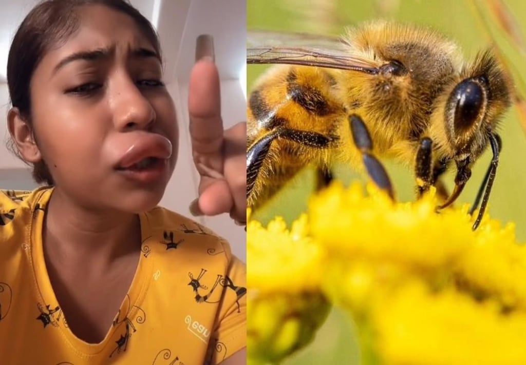 VIRAL: Joven termina con el rostro 'deformado' tras sufrir una picadura de abeja