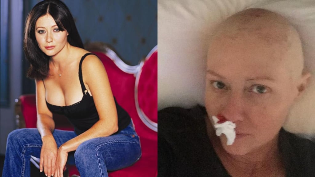 Shannen Doherty muestra en fotos su dura lucha contra el cáncer