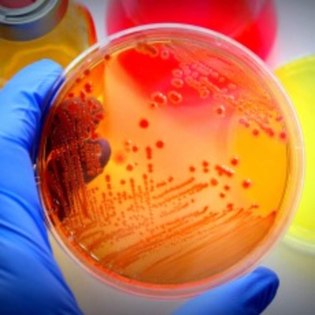 Científicos desarrollan hidrocarburos a partir de los azúcares de la bacteria E.coli
