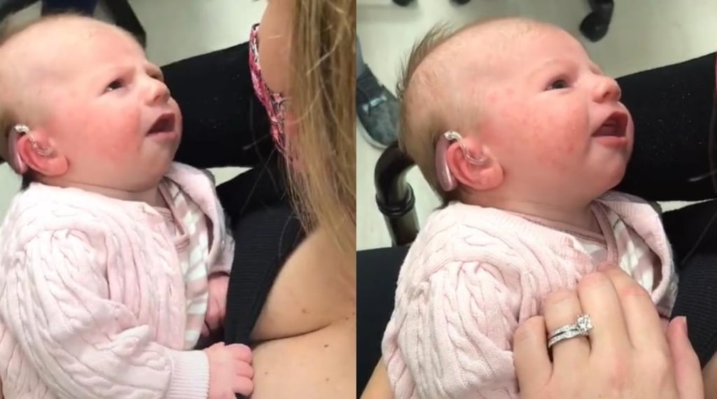 Reacción de una bebé sorda al escuchar la voz de su madre por primera vez se vuelve viral