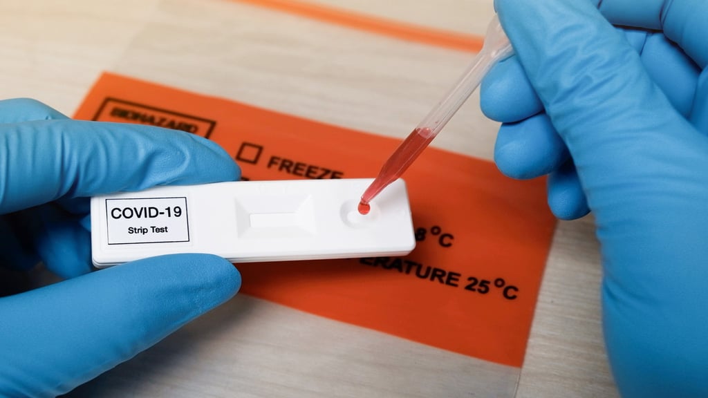 Anticuerpos de SARS-CoV-2 se reducen rápido con VIH