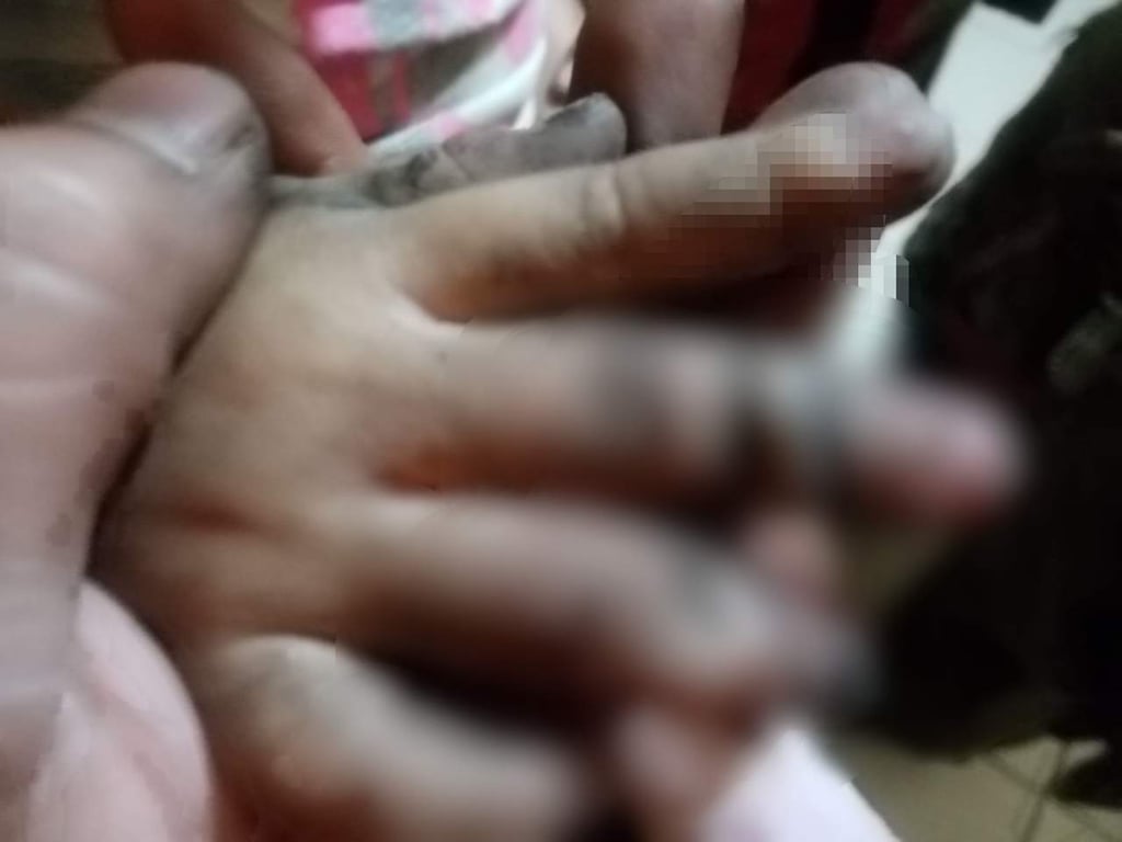 Manita de niña se atora en cadena de bicicleta; fue trasladada al Materno Infantil