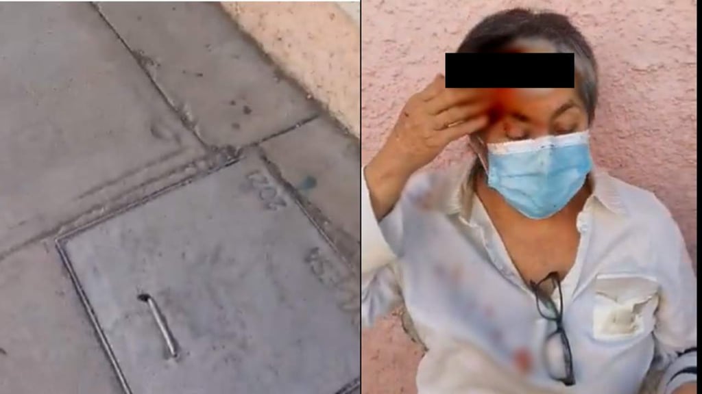 Por malas condiciones de banquetas, señora sufre caída en calles del Centro de Durango