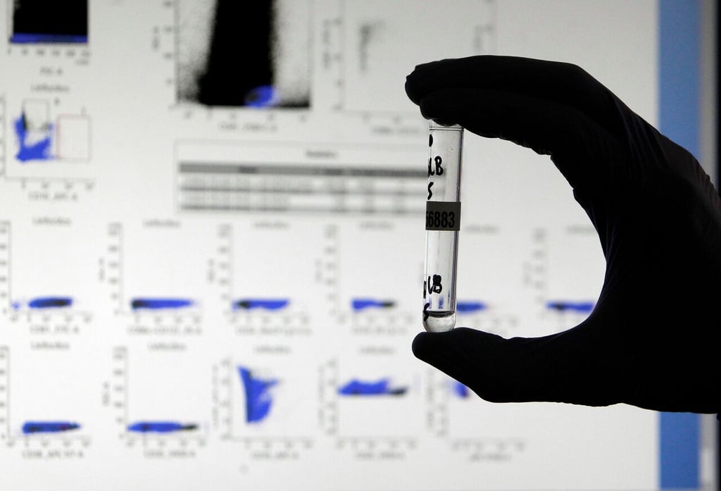 Un dispositivo permite ver el nivel de anticuerpos tras la vacuna del covid