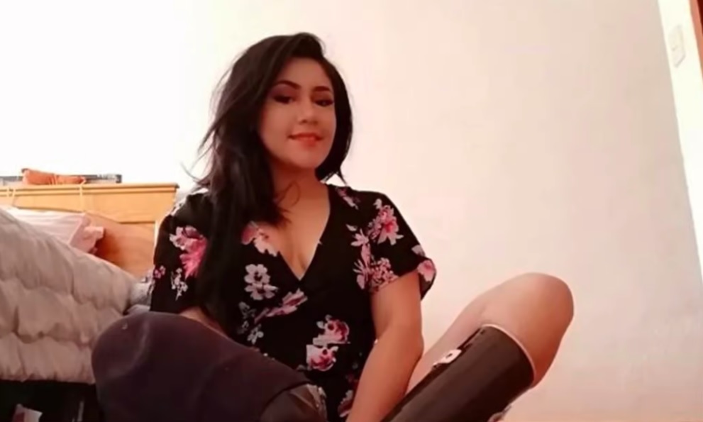 Tras negligencia médica, IMSS indemnizará a mujer que sufrió amputación