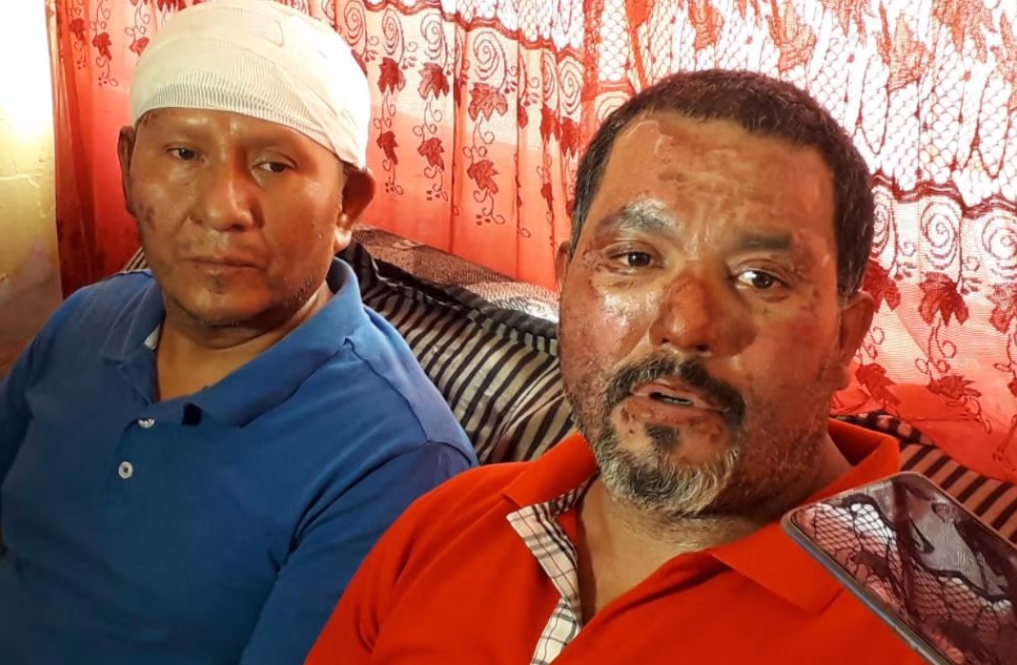 Víctimas de flamazo en Gómez Palacio piden ayuda legal ante la desatención de empresa gasera