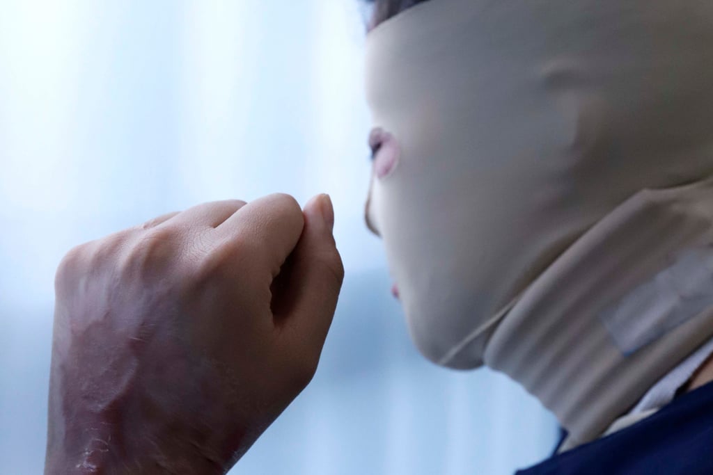 Piden mayores penas para responsables de agresiones con ácido a mujeres en México