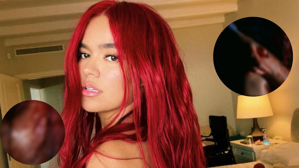 ¿Qué le pasó? Karol G aparece cubierta de sangre