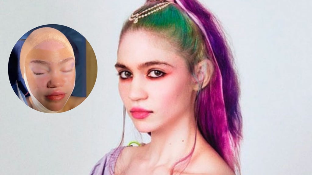 ¿Se hizo cirugía? Grimes sorprende con nueva apariencia en su cara