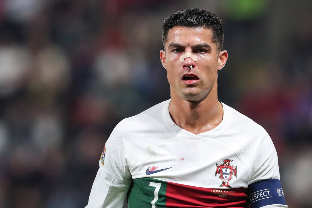 Cristiano recibe fuerte golpe en el rostro durante el Portugal Vs. República Checa