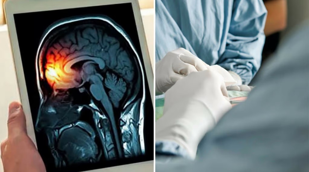 Así se enferma de meningitis y esto se sabe sobre el brote en Durango