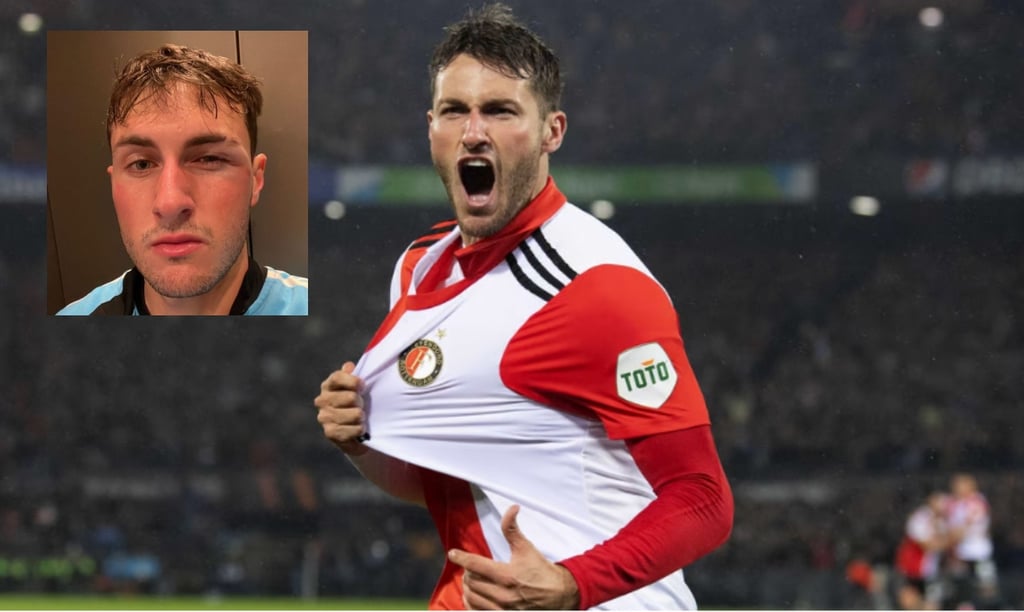 'Quise defender a Messi', Santiago Giménez aparece con el ojo morado en redes sociales