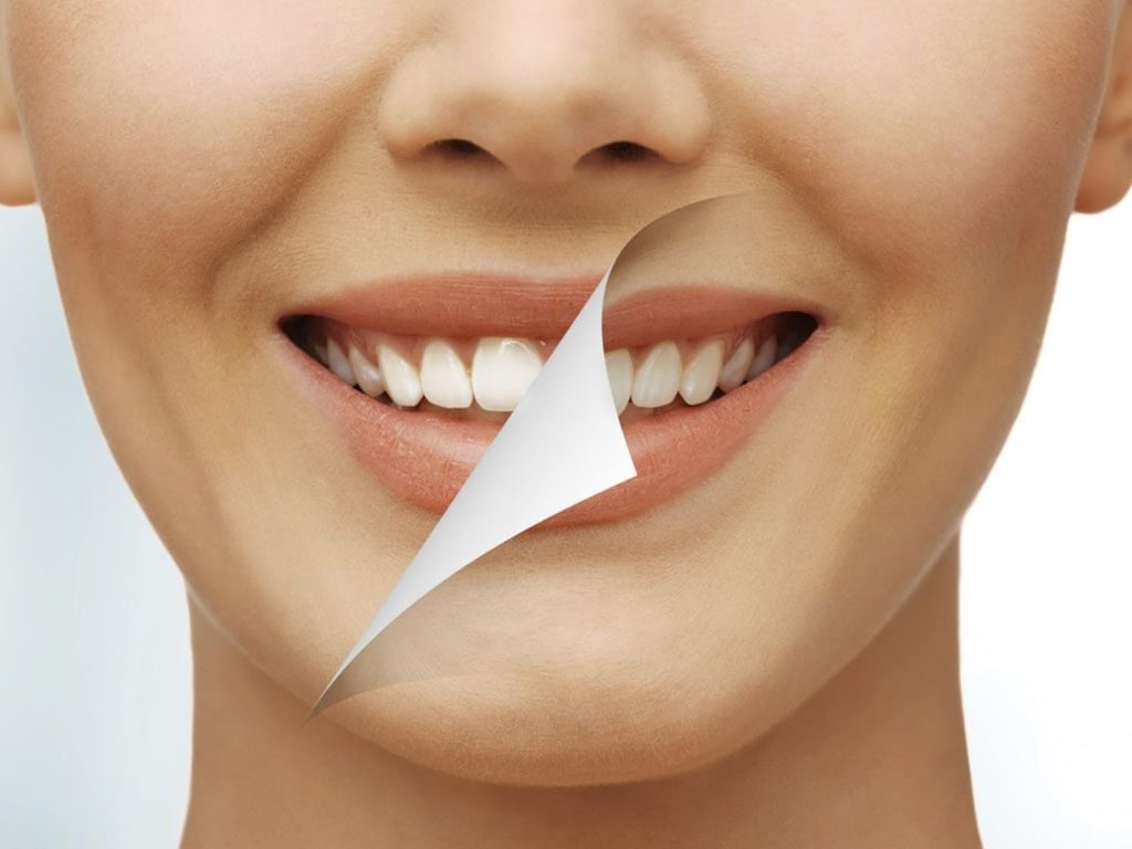 Alimentos para blanquear dientes