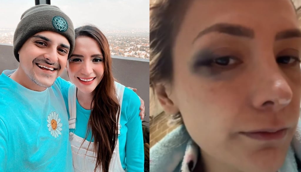 ¿Qué está pasando con Pao Poulain y 'Fichis', hermano de Yuya? La influencer aparece golpeada