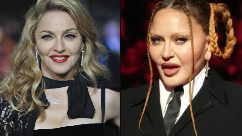 Madonna está desesperada por volver a tener su apariencia natural, señalan medios internacionales