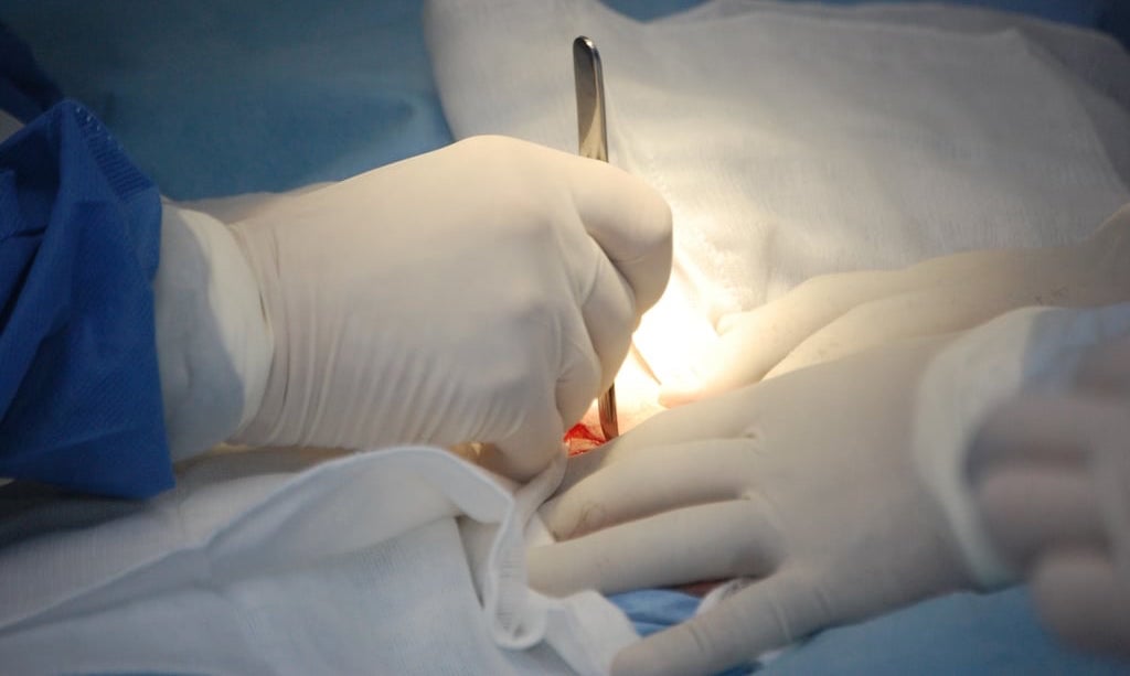 Durango ofrece apoyo por casos de meningitis en Tamaulipas