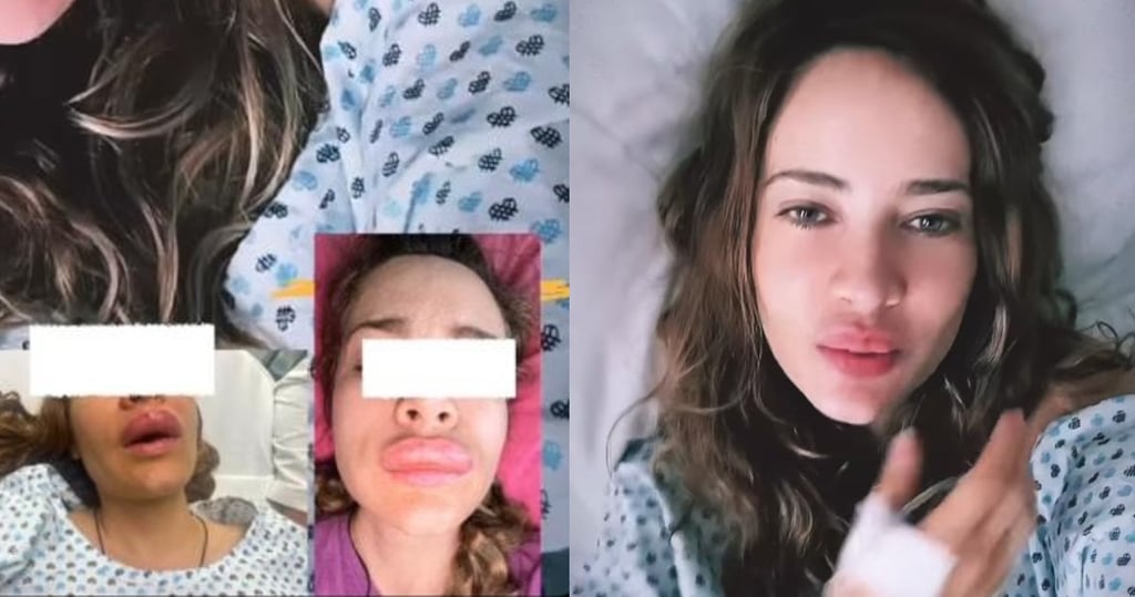 ¿Qué le pasó? Jolette preocupa al aparecer desde la cama de un hospital y con los labios hinchados