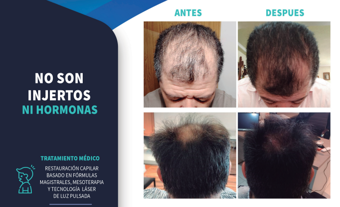 Clínica Nuvimar, al servicio del cuidado capilar en Durango