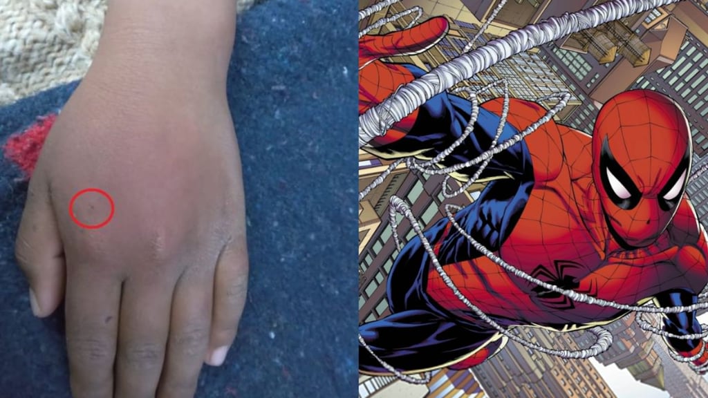 Niño se deja picar por viuda negra para convertirse en Spider-man