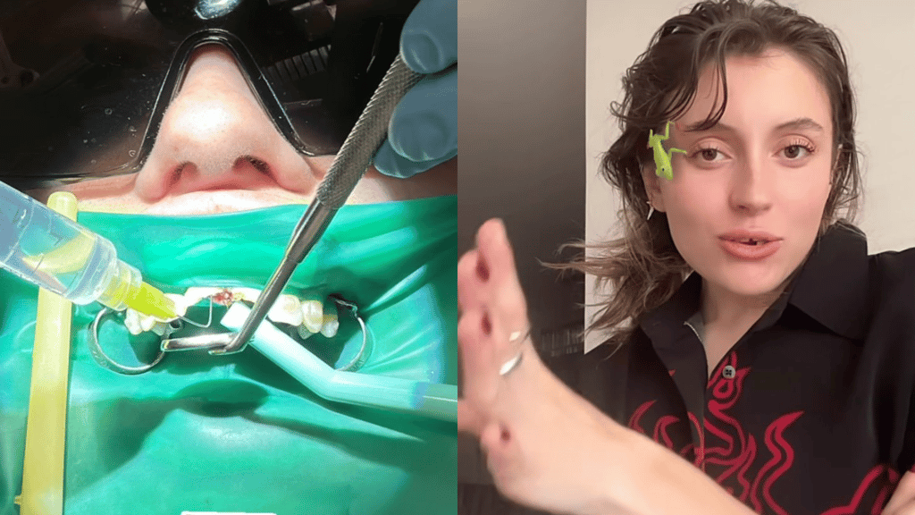 ¡Terminó sin dientes! Hija de Angélica Rivera sufre aparatoso accidente en caballo