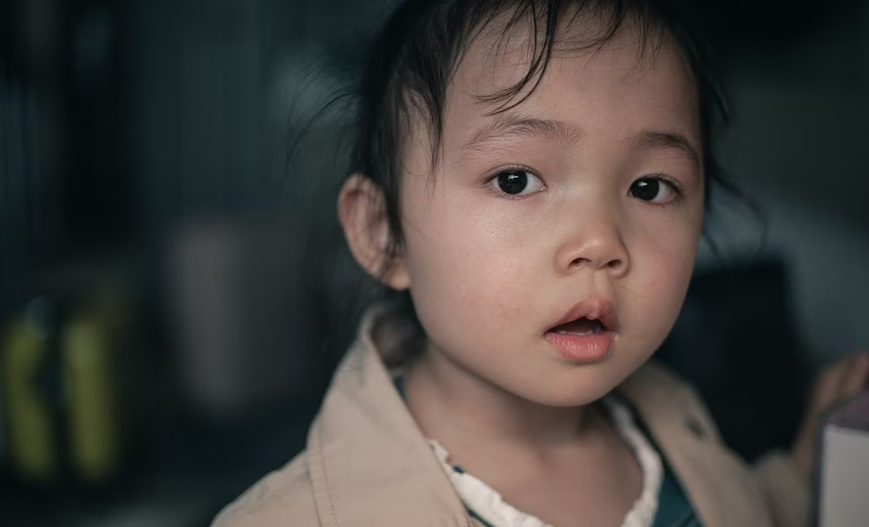 El síndrome de Kabuki y los signos de alerta