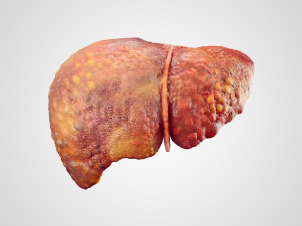 Combatir el hígado graso con frutas